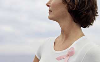 Симптомы, методы лечения и профилактика рака груди