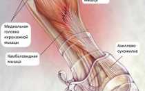 Растяжение икроножной мышцы: симптомы и лечение боли
