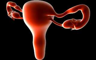 Возможные причины и способы лечения смещения матки. Особенности патологии