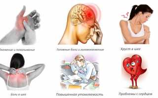 Таблетки от головокружения при шейном остеохондрозе: список лекарств