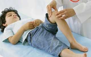 По каким причинам у ребенка болят колени, диагностика и методы лечения патологий