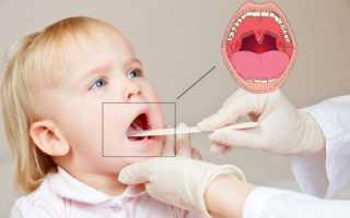 Горловой кашель у ребенка, как лечить – что нужно знать родителям