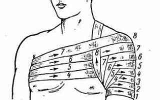 Колосовидная повязка на плечевой сустав: как использовать