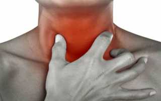 Боль в горле при шейном остеохондрозе: как диагностировать, чем лечить