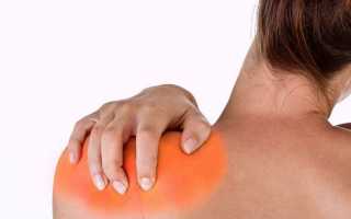 Растяжение связок плеча (плечевого сустава): причины, симптомы, лечение