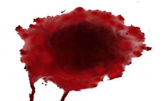 Причины того почему кровь во время месячных идет сгустками