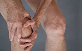 Гонартроз коленного сустава 3 степени: причины, симптомы, лечение