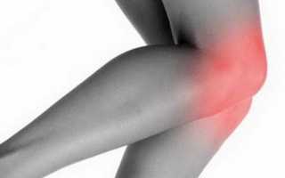 Ушиб колена при падении: лечение в домашних условиях, оказание первой помощи