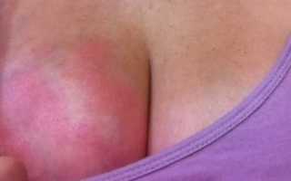 Особенности груди во время месячных, что считается нормой?