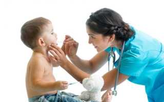 Герпесная ангина у детей: как заметить и как лечить?
