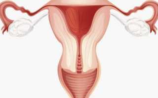 Возможные причины, симптомы и пути лечения гипоплазии матки