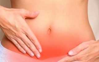 Причины возникновения фибромотоза матки, методы диагностики профилактики и лечения