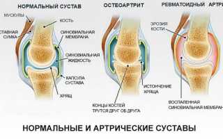 Причины появления болей в суставах ног – полный анализ, диагностика и лечение