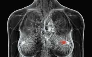 Подготовка, особенности и виды биопсии грудных желез
