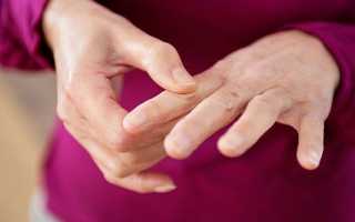 Боль в суставах пальцев рук: причины и лечение, что делать если болят суставы пальцев